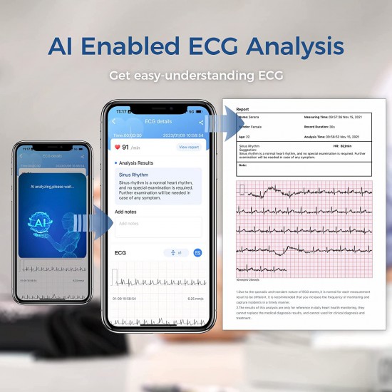 CheckMe BP2 Connect Wireless Blood Pressure and ECG Monitor REVIEW 